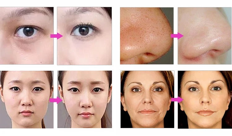 Microdermabrasion Machine- 7 in 1 Oxygen Skin care Skincare